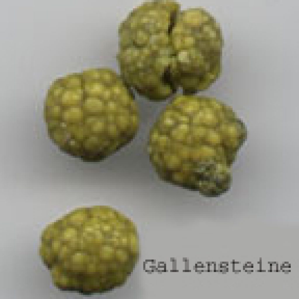 gallensteine Ordination Grünberger